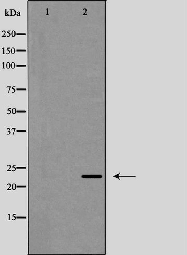 IL-12 p70 Antibody in Western Blot (WB)