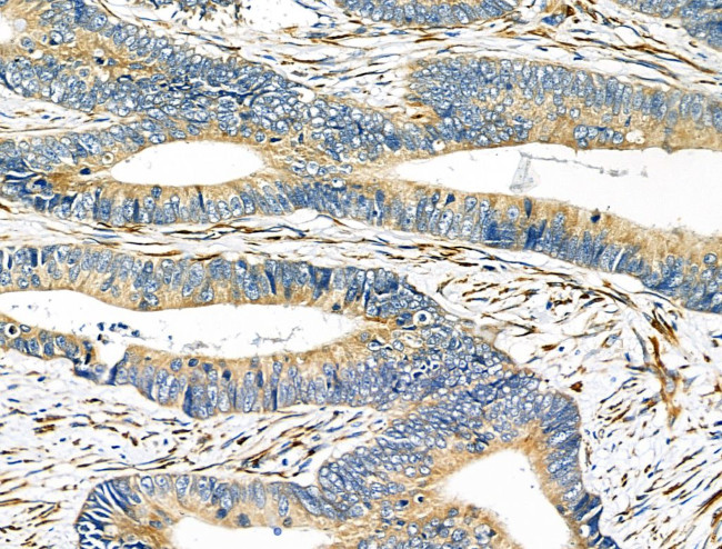 IL-12 p40 Antibody in Immunohistochemistry (Paraffin) (IHC (P))