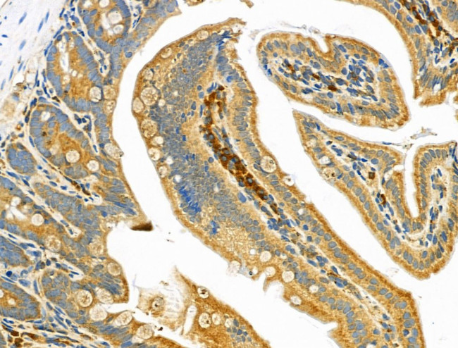 IL-12 p40 Antibody in Immunohistochemistry (Paraffin) (IHC (P))