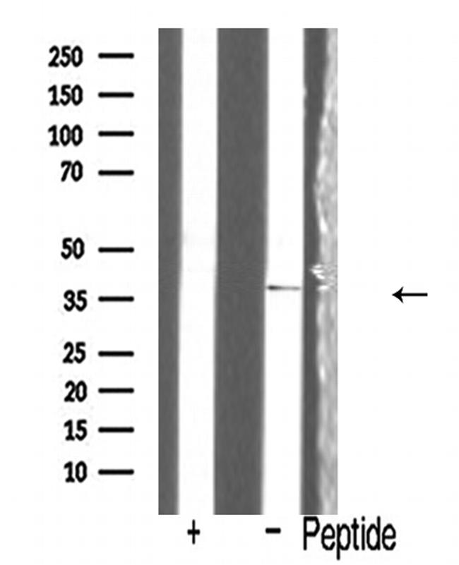 IL-12 p40 Antibody in Western Blot (WB)