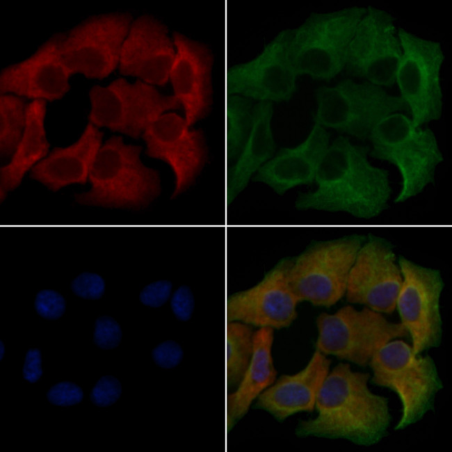 CD218a (IL-18Ra) Antibody in Immunocytochemistry (ICC/IF)