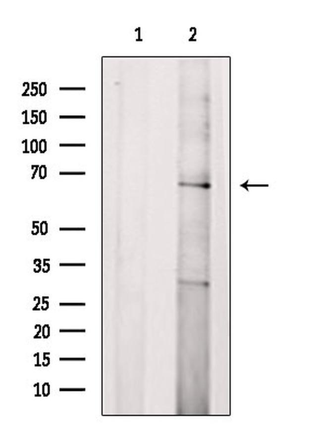 CD218a (IL-18Ra) Antibody in Western Blot (WB)