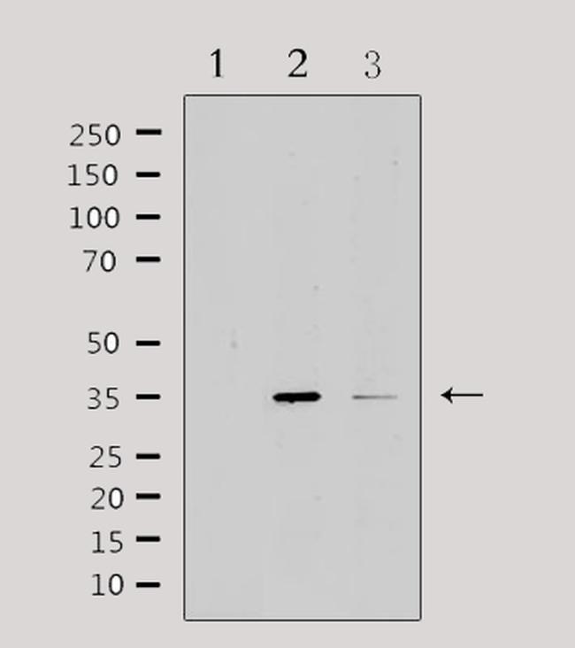 IL20RB Antibody in Western Blot (WB)