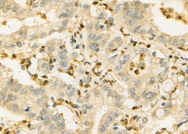 IL-21 Antibody in Immunohistochemistry (Paraffin) (IHC (P))