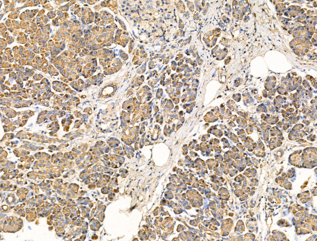 IL-22 Receptor alpha Antibody in Immunohistochemistry (Paraffin) (IHC (P))