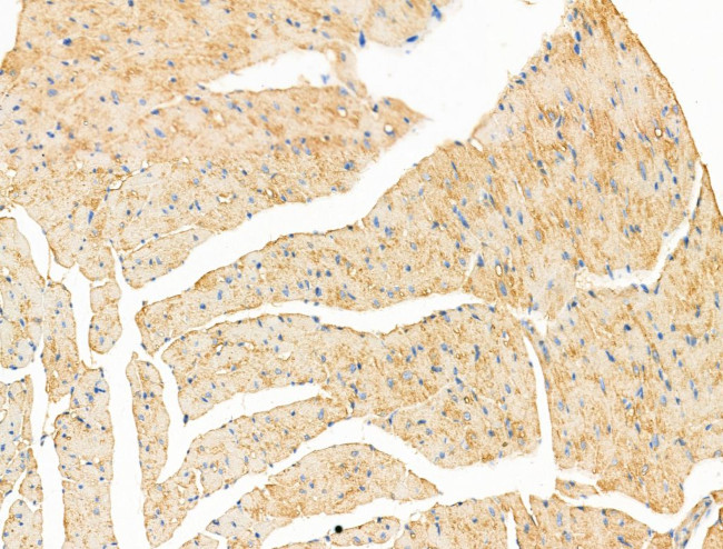 IL-22 Receptor alpha Antibody in Immunohistochemistry (Paraffin) (IHC (P))