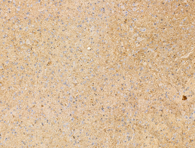 IL-22 Receptor alpha Antibody in Immunohistochemistry (Paraffin) (IHC (P))