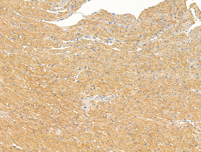 IL-22 Receptor alpha Antibody in Immunohistochemistry (Paraffin) (IHC (P))