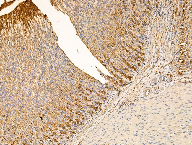 IL-22 Receptor alpha Antibody in Immunohistochemistry (Paraffin) (IHC (P))