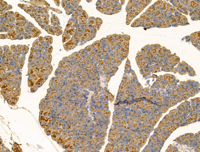 IL-22 Receptor alpha Antibody in Immunohistochemistry (Paraffin) (IHC (P))