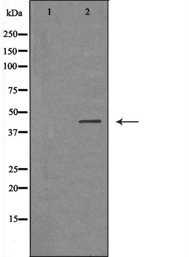 IL2RG Antibody in Western Blot (WB)