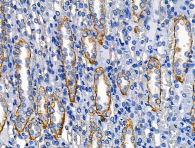 IL-4 Antibody in Immunohistochemistry (Paraffin) (IHC (P))