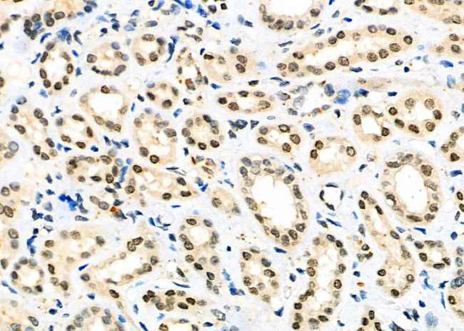 ILF3 Antibody in Immunohistochemistry (Paraffin) (IHC (P))