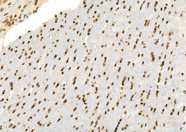 ILF3 Antibody in Immunohistochemistry (Paraffin) (IHC (P))