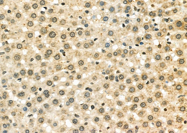 ILF3 Antibody in Immunohistochemistry (Paraffin) (IHC (P))