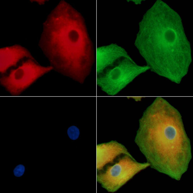 IL1RL2 Antibody in Immunocytochemistry (ICC/IF)