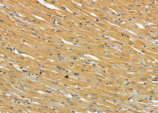 IL1RL2 Antibody in Immunohistochemistry (Paraffin) (IHC (P))