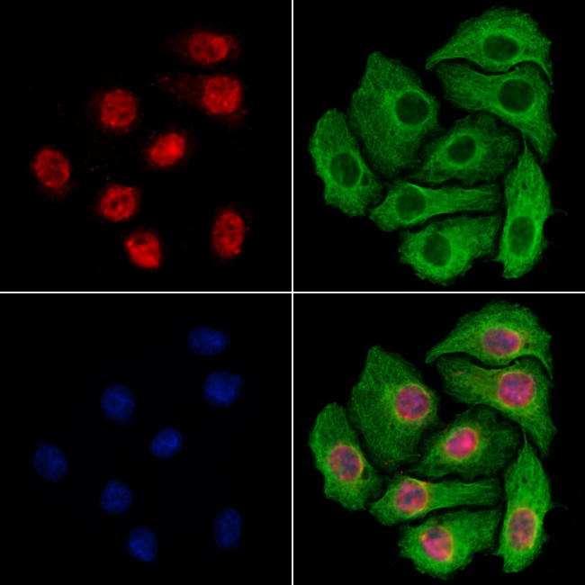 Importin 7 Antibody in Immunocytochemistry (ICC/IF)