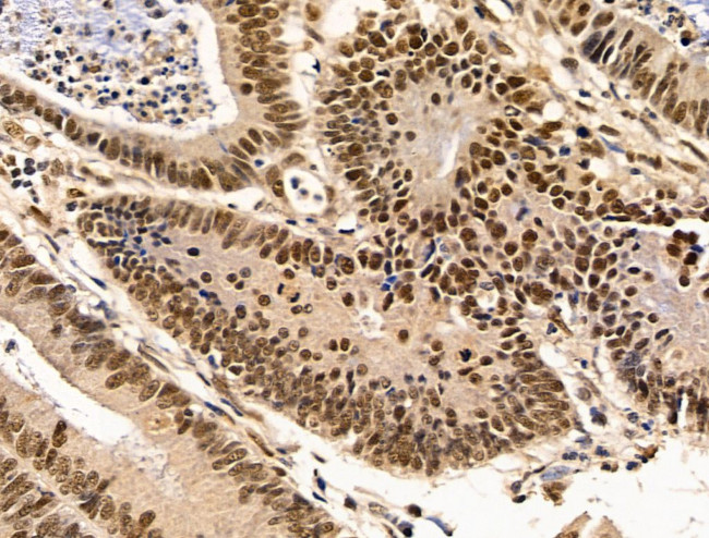 Importin 7 Antibody in Immunohistochemistry (Paraffin) (IHC (P))