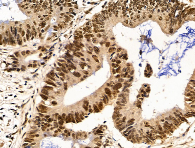 Importin 7 Antibody in Immunohistochemistry (Paraffin) (IHC (P))