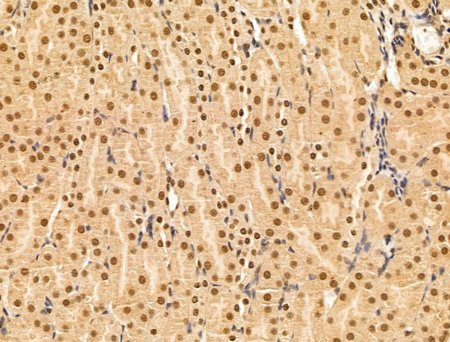 Importin 7 Antibody in Immunohistochemistry (Paraffin) (IHC (P))