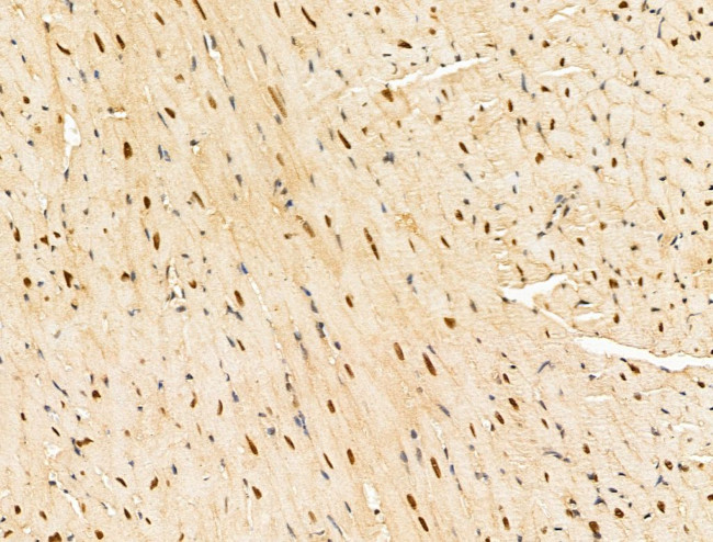 Importin 7 Antibody in Immunohistochemistry (Paraffin) (IHC (P))