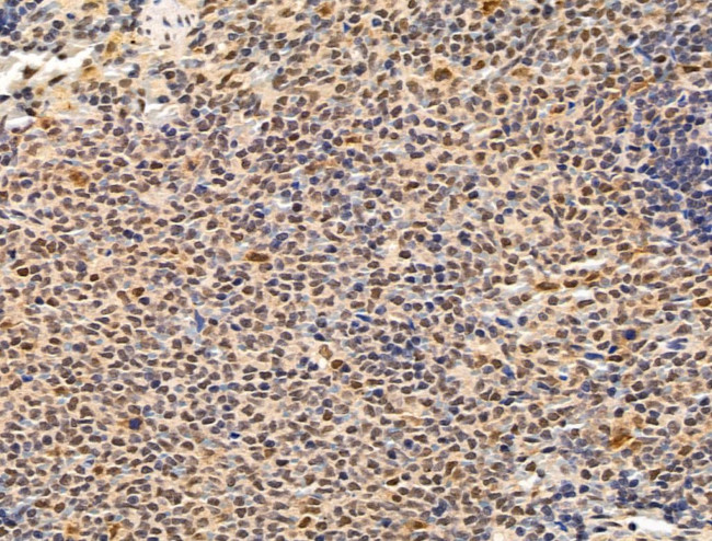 Importin 7 Antibody in Immunohistochemistry (Paraffin) (IHC (P))