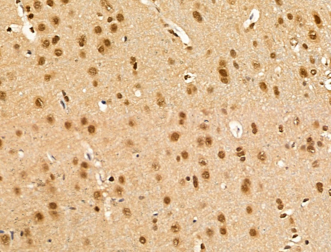 Importin 7 Antibody in Immunohistochemistry (Paraffin) (IHC (P))