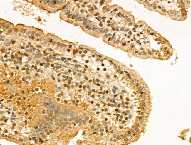 Importin beta-1 Antibody in Immunohistochemistry (Paraffin) (IHC (P))