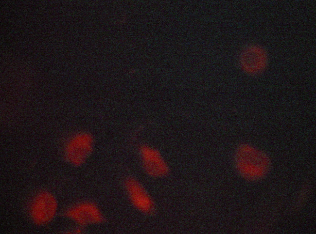 INSR Antibody in Immunocytochemistry (ICC/IF)