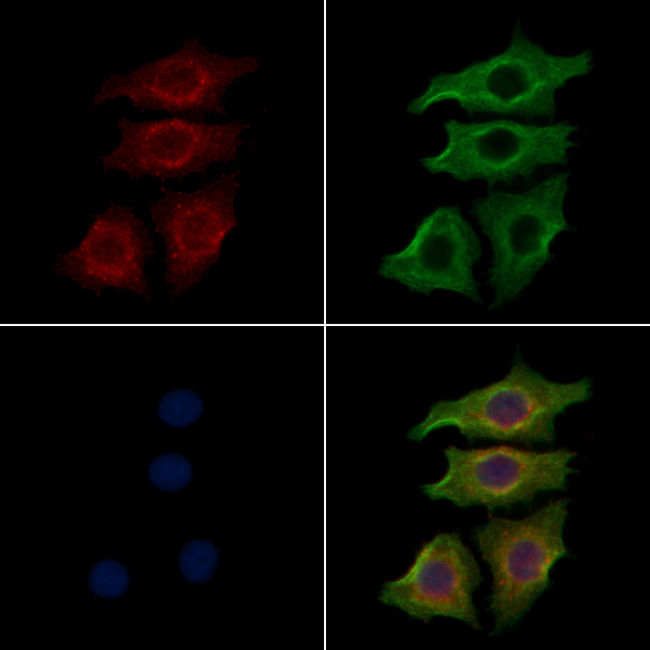 INSR Antibody in Immunocytochemistry (ICC/IF)