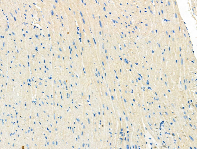 ITGA5 Antibody in Immunohistochemistry (Paraffin) (IHC (P))