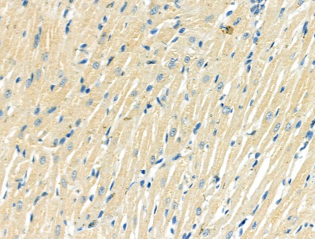 ITGA5 Antibody in Immunohistochemistry (Paraffin) (IHC (P))