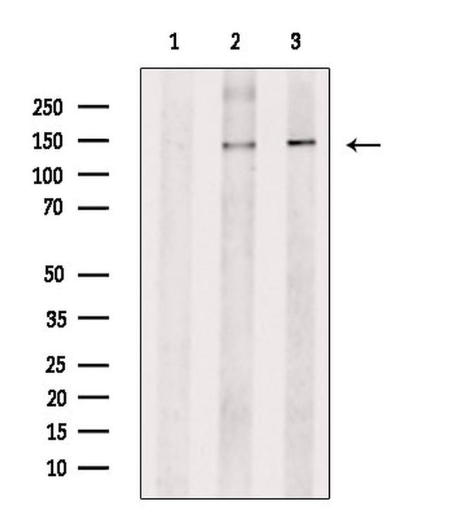 ITGA5 Antibody in Western Blot (WB)