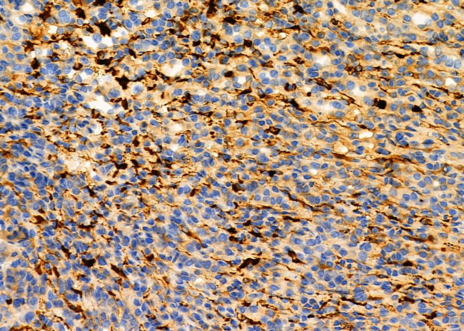 IFN alpha Antibody in Immunohistochemistry (Paraffin) (IHC (P))