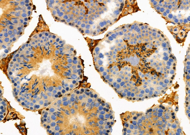 IFN alpha Antibody in Immunohistochemistry (Paraffin) (IHC (P))