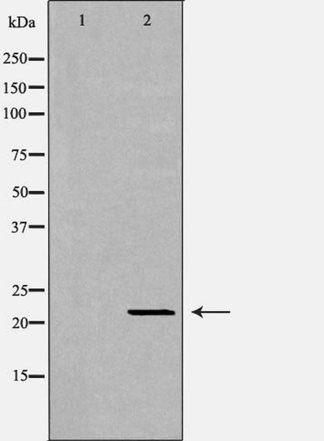 IFN alpha Antibody in Western Blot (WB)