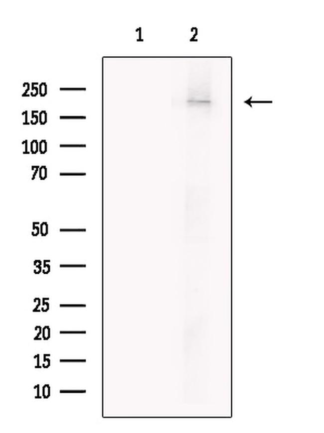 ITSN1 Antibody in Western Blot (WB)