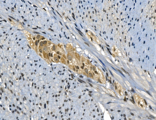 IRF1 Antibody in Immunohistochemistry (Paraffin) (IHC (P))