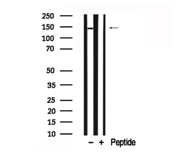 JAK1 Antibody in Western Blot (WB)