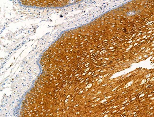 Kallikrein 9 Antibody in Immunohistochemistry (Paraffin) (IHC (P))