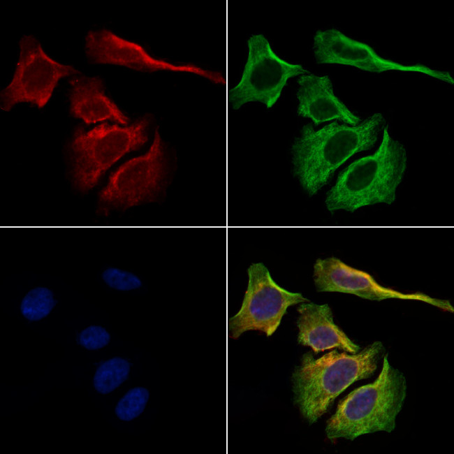 Kappa Light Chain Antibody in Immunocytochemistry (ICC/IF)