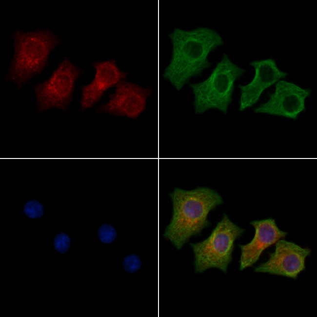 KVbeta2 (KCNAB2) Antibody in Immunocytochemistry (ICC/IF)