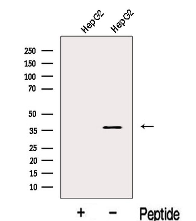 KVbeta2 (KCNAB2) Antibody in Western Blot (WB)