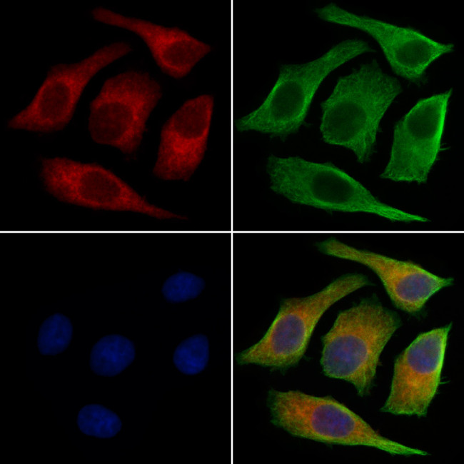 KV3.3 (KCNC3) Antibody in Immunocytochemistry (ICC/IF)