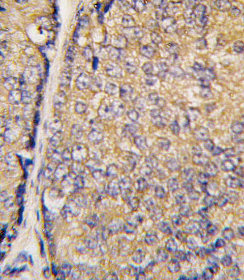 STAP1 Antibody in Immunohistochemistry (Paraffin) (IHC (P))