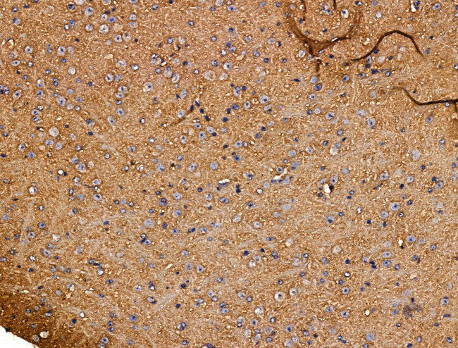 KCNK10 Antibody in Immunohistochemistry (Paraffin) (IHC (P))