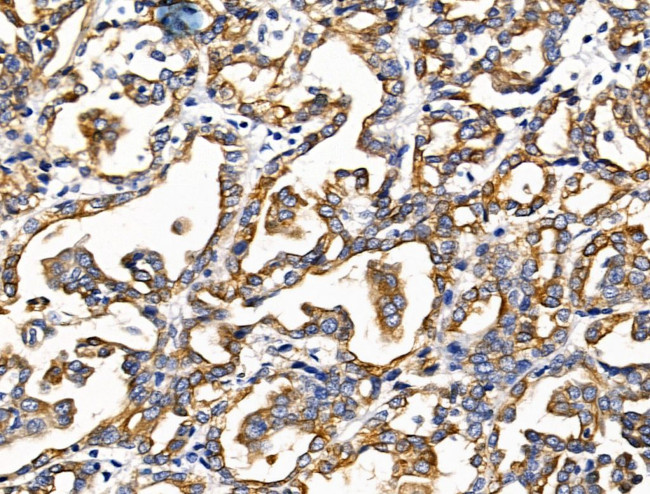 KCNK9 Antibody in Immunohistochemistry (Paraffin) (IHC (P))