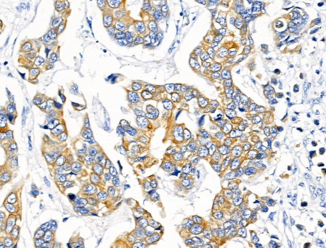 KCNK9 Antibody in Immunohistochemistry (Paraffin) (IHC (P))