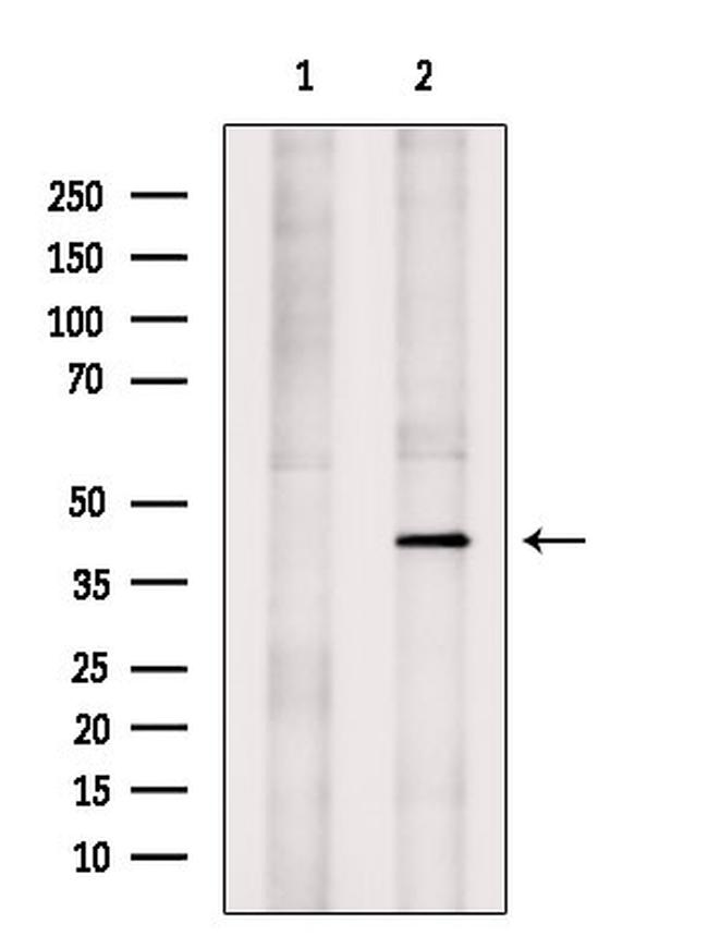 KCNK9 Antibody in Western Blot (WB)